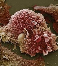 Ученые заставили иммунную систему атаковать рак