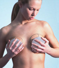 Француженкам порекомендуют расстаться с протезами груди