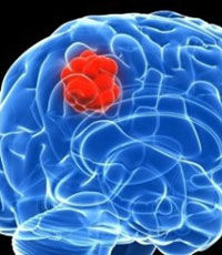 Ученые поняли, как мозг стирает воспоминания