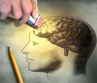 Неврологи предложили новый способ лечения болезни Альцгеймера