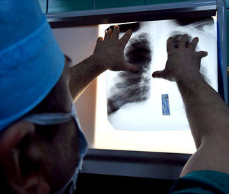 Количество инфицированных пневмонией нового типа в Китае возросло до 45