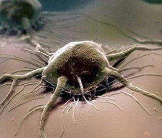 Найден способ заставить клетки организма "поедать" рак