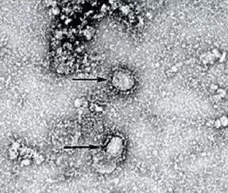 На Украине зафиксировали три случая подозрения на коронавирус