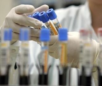 Украина ожидает поставки тест-систем для диагностики нового коронавируса