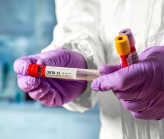 На Украине за сутки выявили 397 новых случая Covid-19
