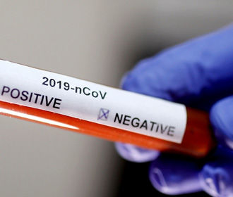 В США рассчитывают, что к осени смогут проводить до 50 млн. тестов на коронавирус в месяц