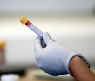 Американские ученые успешно испытали вакцину от ВИЧ