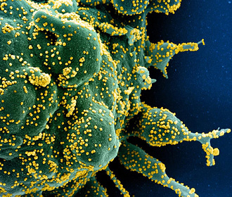 Ученые выяснили, когда появился первый коронавирус