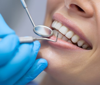 Зубной камень: причины, симптомы и методы удаления