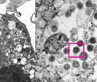 Штамм "омикрон" коронавируса способен частично обходить защиту вакцин от COVID-19 - ученые ЮАР