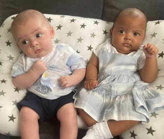 Британка родила близнецов с разным цветом кожи